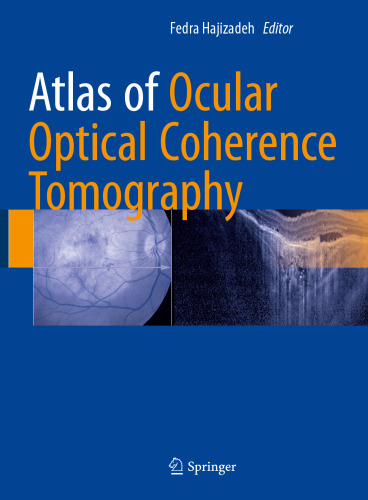  Atlas of Ocular Optical Coherence Tomography