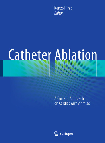  Catheter Ablation: A Current Approach on Cardiac Arrhythmias