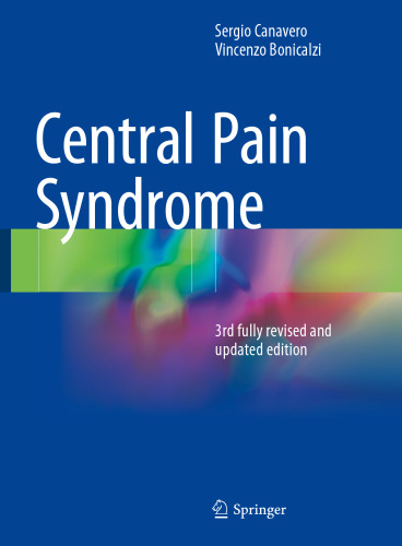  Central Pain Syndrome