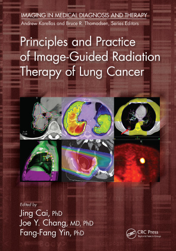 Principles and Practice of Image-Guided Radiation Therapy of Lung Cancer