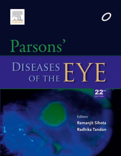 Parsons’ Diseases of the Eye