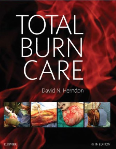 Total Burn Care