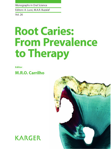 Root Caries: From Prevalence to Therapy