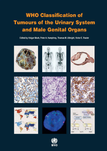 WHO Classification of Tumours of the Urinary System and Male Genital Organs