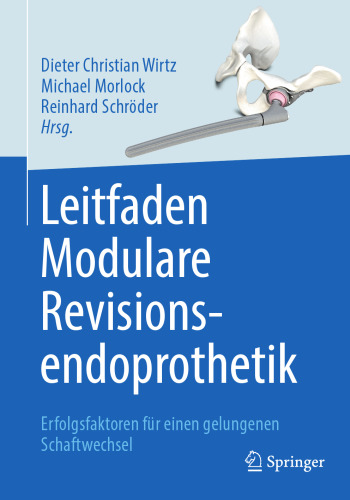 Leitfaden Modulare Revisionsendoprothetik: Erfolgsfaktoren für einen gelungenen Schaftwechsel