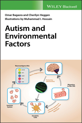 Autism and environmental factors