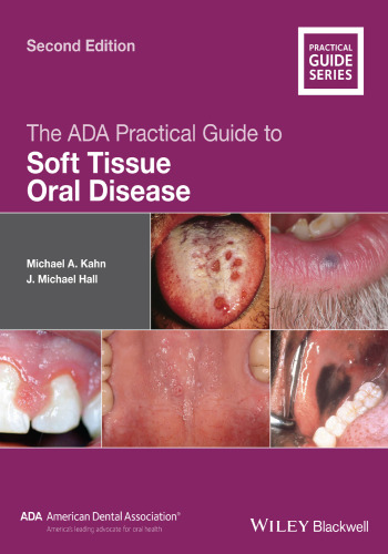 The ADA practical guide to soft tissue oral disease