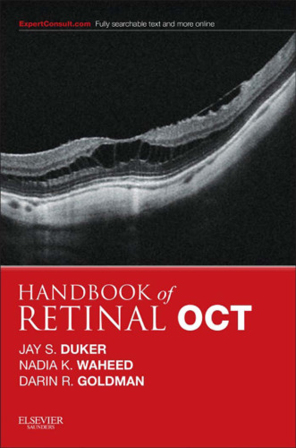 Handbook of Retinal OCT: Optical Coherence Tomography, 1e