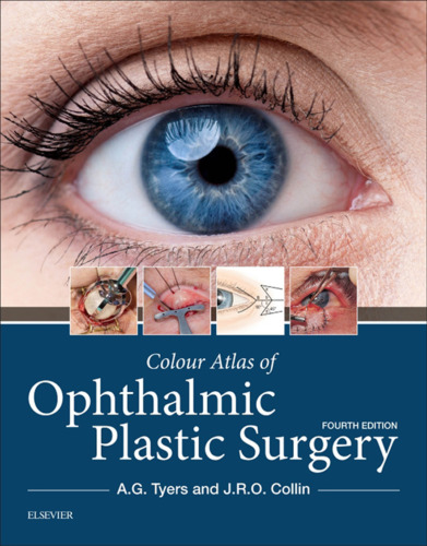 Colour Atlas of Ophthalmic Plastic Surgery