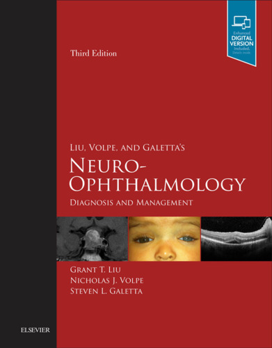 Liu, Volpe, and Galetta’s Neuro-Ophthalmology: Diagnosis and Management, 3e