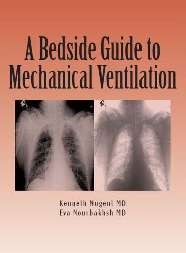 A Bedside Guide to Mechanical Ventilation