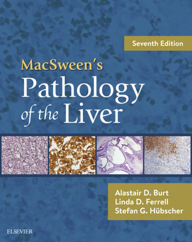 MacSween’s Pathology of the Liver