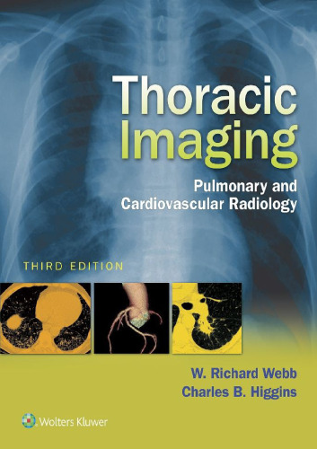 Thoracic Imaging: Pulmonary and Cardiovascular Radiology