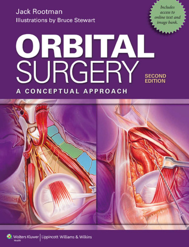 Orbital Surgery: A Conceptual Approach