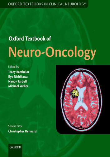 Oxford Textbook of Neuro-Oncology