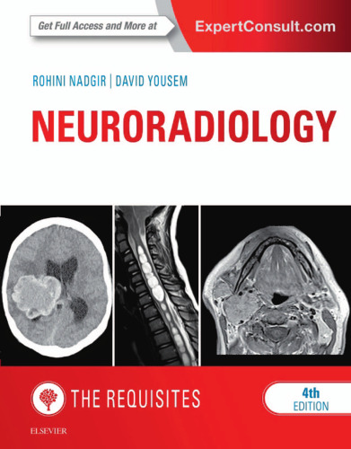 Neuroradiology: The Requisites