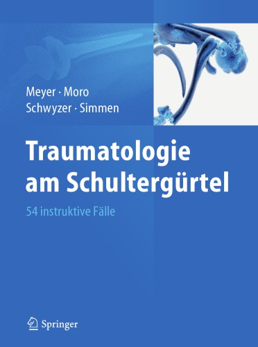 Traumatologie am Schultergürtel : 54 Instruktive Fälle