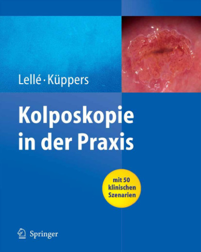 Kolposkopie in der Praxis : mit 24 Tabellen