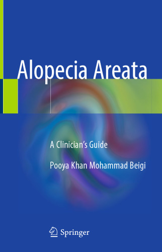 Alopecia Areata