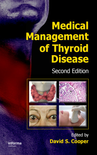 Medical Management of Thyroid Disease, Second Edition