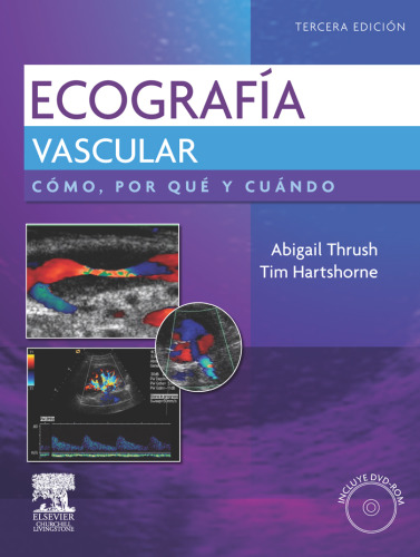 Ecografia Vascular. como, porque y cuando