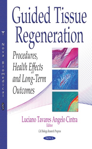 Guided Tissue Regeneration.