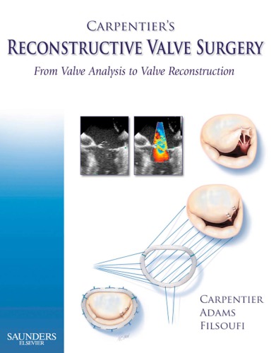 Carpentier’s Reconstructive Valve Surgery