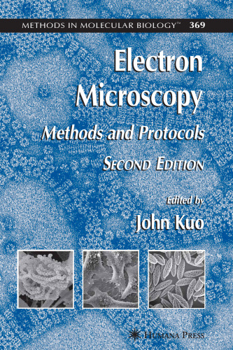 Electron Microscopy: Methods and Protocols