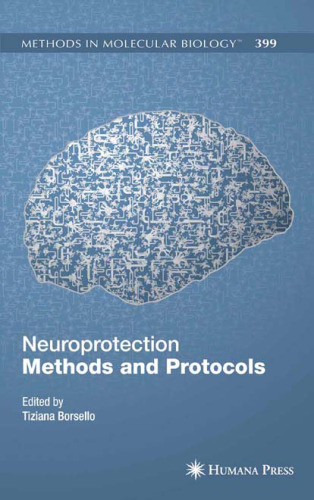 Neuroprotection Methods and Protocols