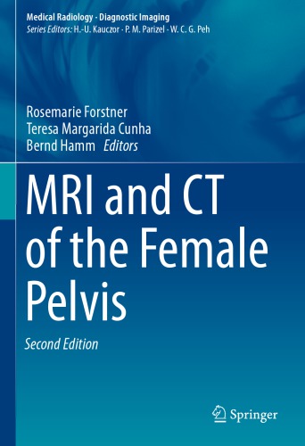 MRI and CT of the Female Pelvis