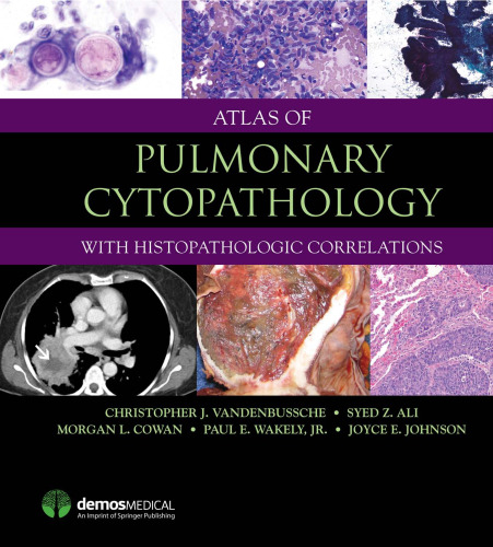 Atlas of Pulmonary Cytopathology