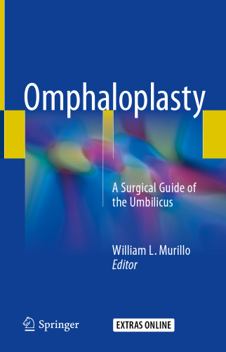 Omphaloplasty: A Surgical Guide of the Umbilicus