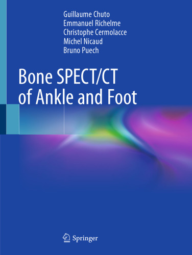 Bone SPECT/CT of Ankle and Foot