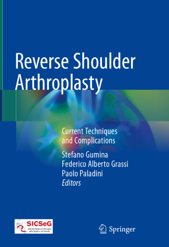 Reverse Shoulder Arthroplasty: Current Techniques and Complications