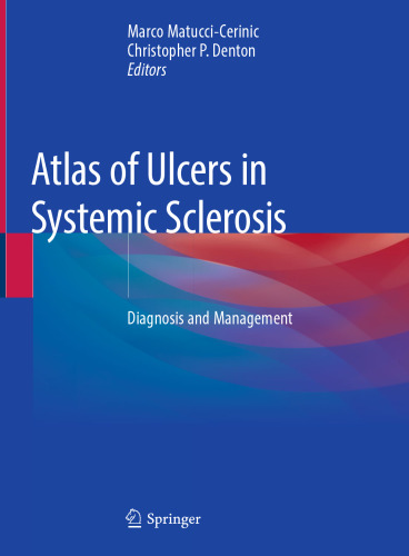 Atlas of Ulcers in Systemic Sclerosis: Diagnosis and Management