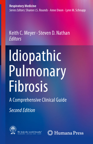 Idiopathic Pulmonary Fibrosis: A Comprehensive Clinical Guide