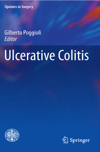 Ulcerative Colitis