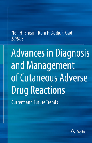 Advances in Diagnosis and Management of Cutaneous Adverse Drug Reactions: Current and Future Trends