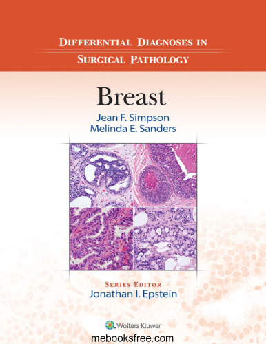 Differential Diagnoses in Surgical Pathology: Breast