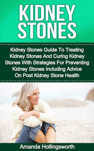 Kidney Stones: Kidney Stones Guide To Treatment Of Kidney Stones And Cure Of Kidney Stones With Diet Strategies For Prevention Of Kidney Stones Including ... (Gastrointestinal Health And Kidney Stones)