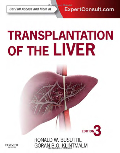 Transplantation of the liver