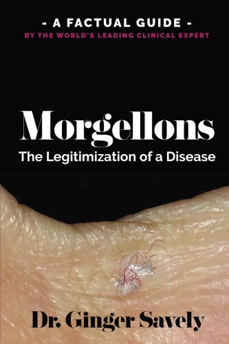 Morgellons: The legitimization of a disease: A Factual Guide by the World’s Leading Clinical Expert