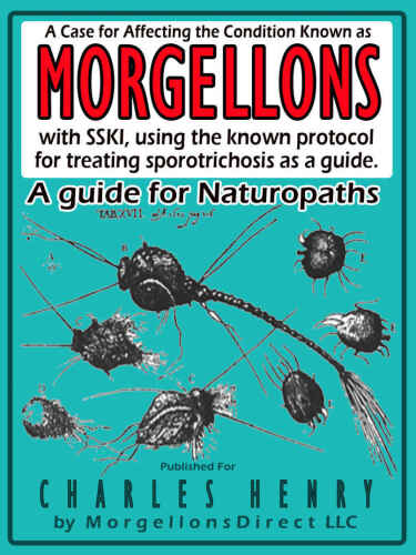 A Case for Affecting the Condition Known as: Morgellons: with SSKI (Super Saturated Potassium Iodide)