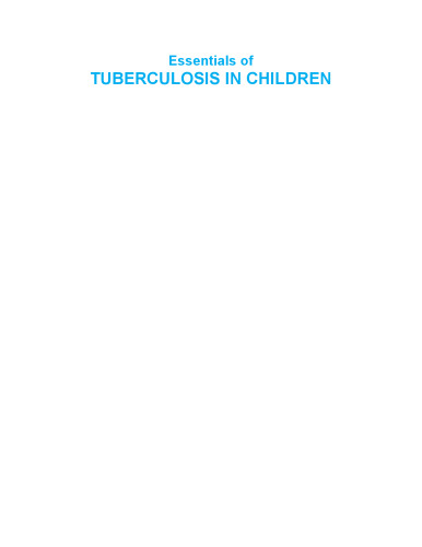 Essentials Of Tuberculosis In Children