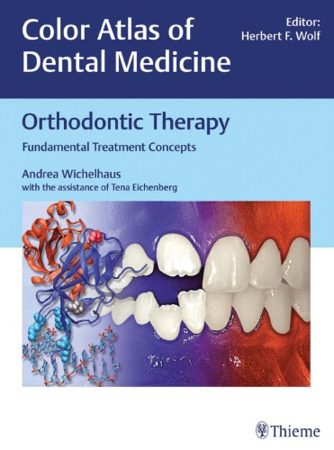 Orthodontic Therapy: Fundamental Treatment Concepts (Color Atlas of Dental Medicine)