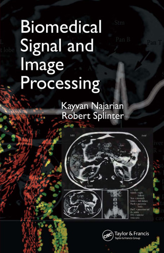 Biomedical signal and image processing