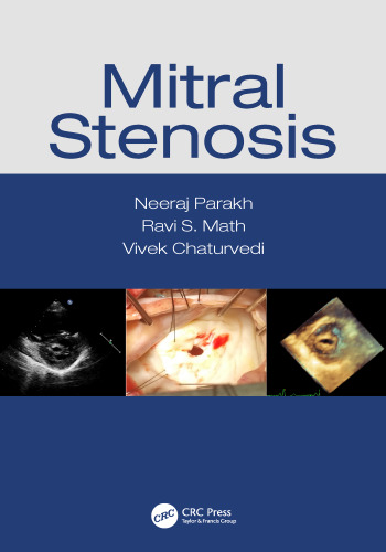 Mitral stenosis