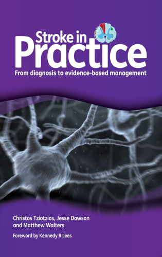 Stroke in practice: from diagnosis to evidence-based management