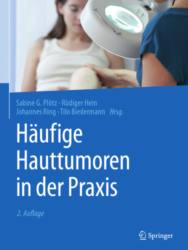 Häufige Hauttumoren in der Praxis