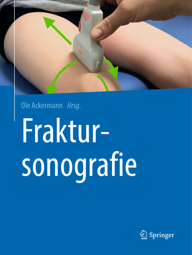 Fraktursonografie